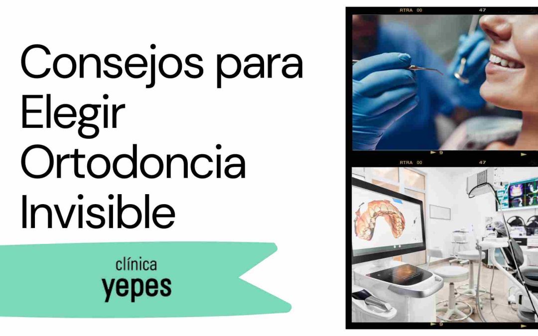 Consejos para Elegir Ortodoncia Invisible